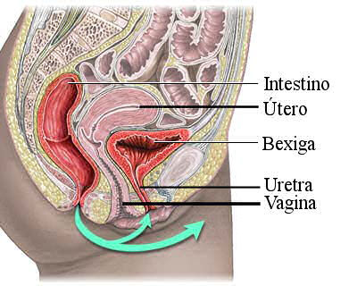 Sepse do aparelho do trato urinário