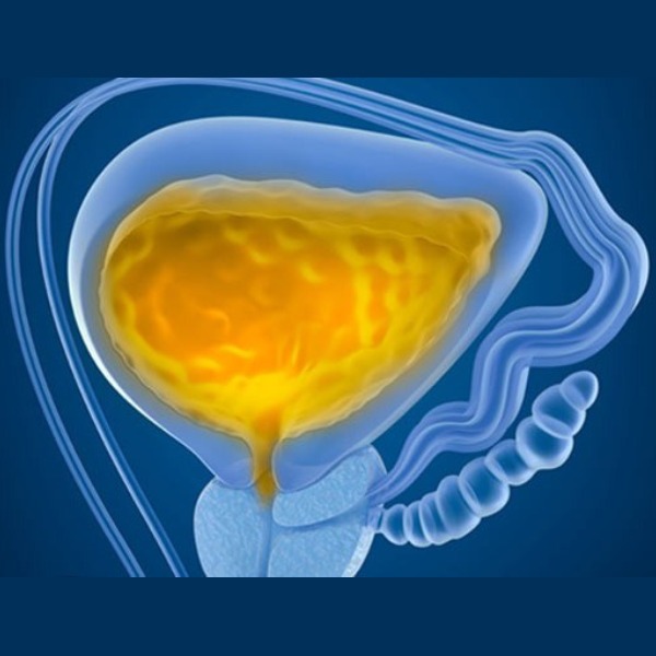 Bexiga Neurogênica